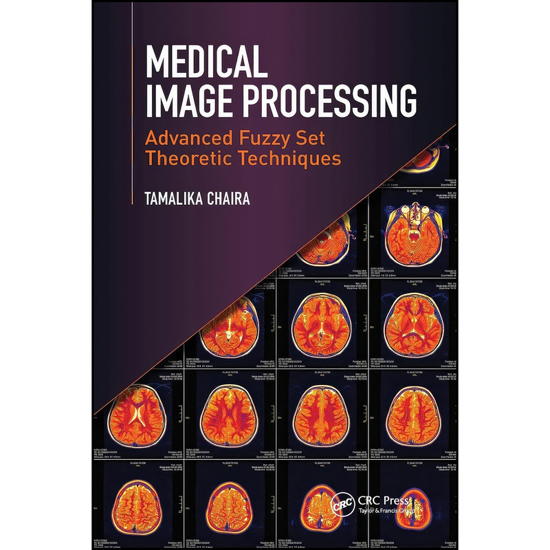 کتاب Medical Image Processing اثر Tamalika Chaira انتشارات تازه ها