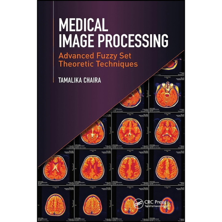 کتاب Medical Image Processing اثر Tamalika Chaira انتشارات تازه ها